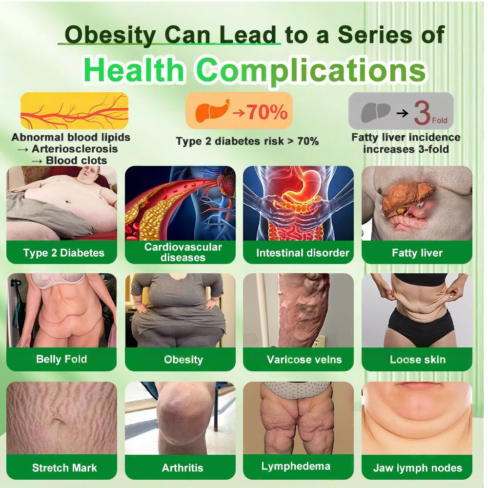 New Arrival | Bnodo® 𝗚𝗟𝗣-𝟭 𝟐𝟎-𝐢𝐧-𝟏 𝐒𝐥𝐢𝐦& 𝑯𝒆𝒂𝒍𝒕𝒉𝐲 𝑶𝒓𝒂𝒍 𝑺𝒐𝒍𝒖𝒕𝒊𝒐𝒏 𝑂𝑛𝑐𝑒 𝑎 𝑑𝑎𝑦, 𝑣𝑖𝑠𝑖𝑏𝑙𝑒 𝑟𝑒𝑠𝑢𝑙𝑡𝑠 𝑖𝑛 7 𝑑𝑎𝑦𝑠  ✅ 𝗦𝘂𝗽𝗽𝗼𝗿𝘁𝘀 𝗼𝗯𝗲𝘀𝗶𝘁𝘆, 𝗰𝗮𝗿𝗱𝗶𝗼𝘃𝗮𝘀𝗰𝘂𝗹𝗮𝗿 𝗵𝗲𝗮𝗹𝘁𝗵, 𝗱𝗶𝗮𝗯𝗲𝘁𝗲𝘀, 𝘀𝗹𝗲𝗲𝗽 𝗮𝗽𝗻𝗲𝗮, 𝗴𝘂𝘁 𝗵𝗲𝗮𝗹𝘁𝗵, 𝗷𝗼𝗶𝗻𝘁 𝗶𝘀𝘀𝘂𝗲𝘀, 𝐰𝐡𝐢𝐥𝐞 𝐚𝐥𝐬𝐨 𝐟𝐢𝐫𝐦𝐢𝐧𝐠 𝐭𝐡𝐞 𝐬𝐤𝐢𝐧 𝐚𝐧𝐝 𝐛𝐨𝐨𝐬𝐭𝐢𝐧𝐠 𝐞𝐧𝐞𝐫𝐠𝐲.（副本）