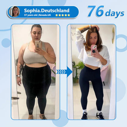 CROAIE ®🌟 Nano Microneedle Patch with SMGT-GLP-1 & Matrixyl 3000 – Slimming, Skin Tightening, Blood Sugar Support, No Injection, 7-Day Result