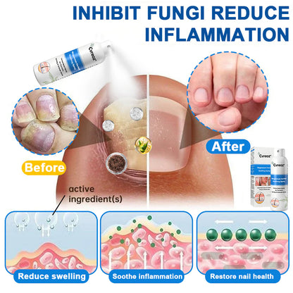 Official Store✅: 𝐂𝐯𝑟𝑒𝑜𝑧® Magnesium Herbal Psoriasis Spray ⚕ MHRA Certified